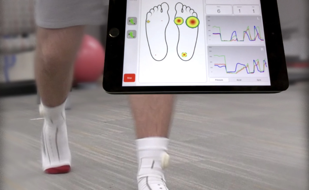 Mayfield Brain & Spine study using Smart Socks to alleviate back pain